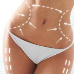 Haben Sie Bikini schon gekauft